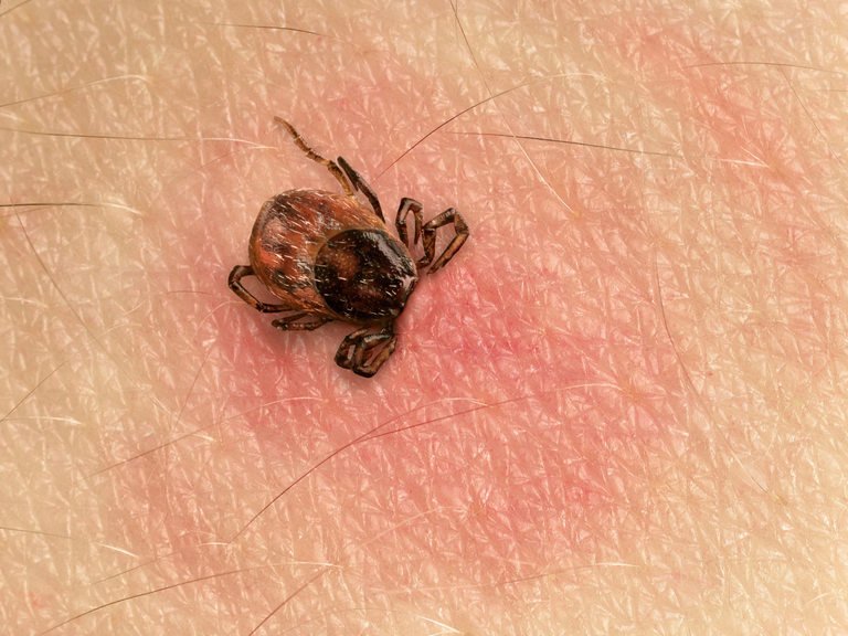 Бум на ухапванията от кърлежи в Кърджали: 19 души стигнаха до Спешното само през април